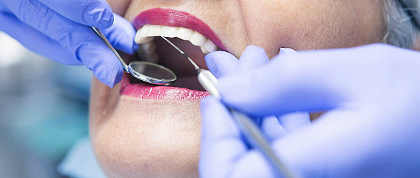 Best Emergency Wisdom Tooth Extraction in Zion, PA